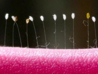 女子发现阳台上的衣架长出草蛉虫卵 究竟怎么回事