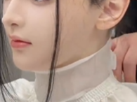 “长相完美”听障女孩植入人工耳蜗 正在进行语训康复!